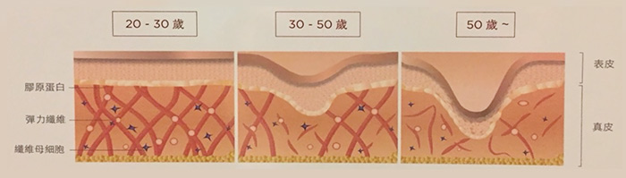 平均每年約流失1%膠原蛋白量