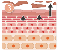 美白換膚療程原理三