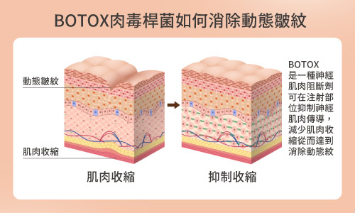 肉毒桿菌圖解