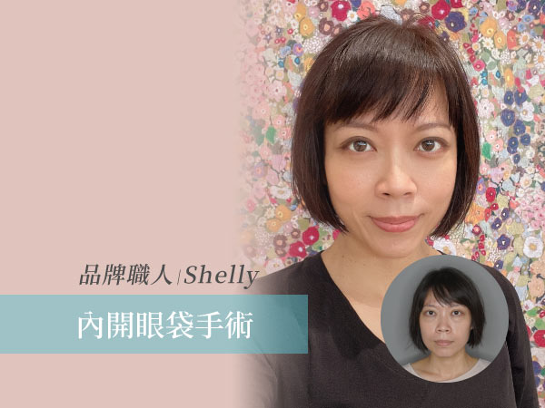 品牌職人Shelly內開眼袋手術